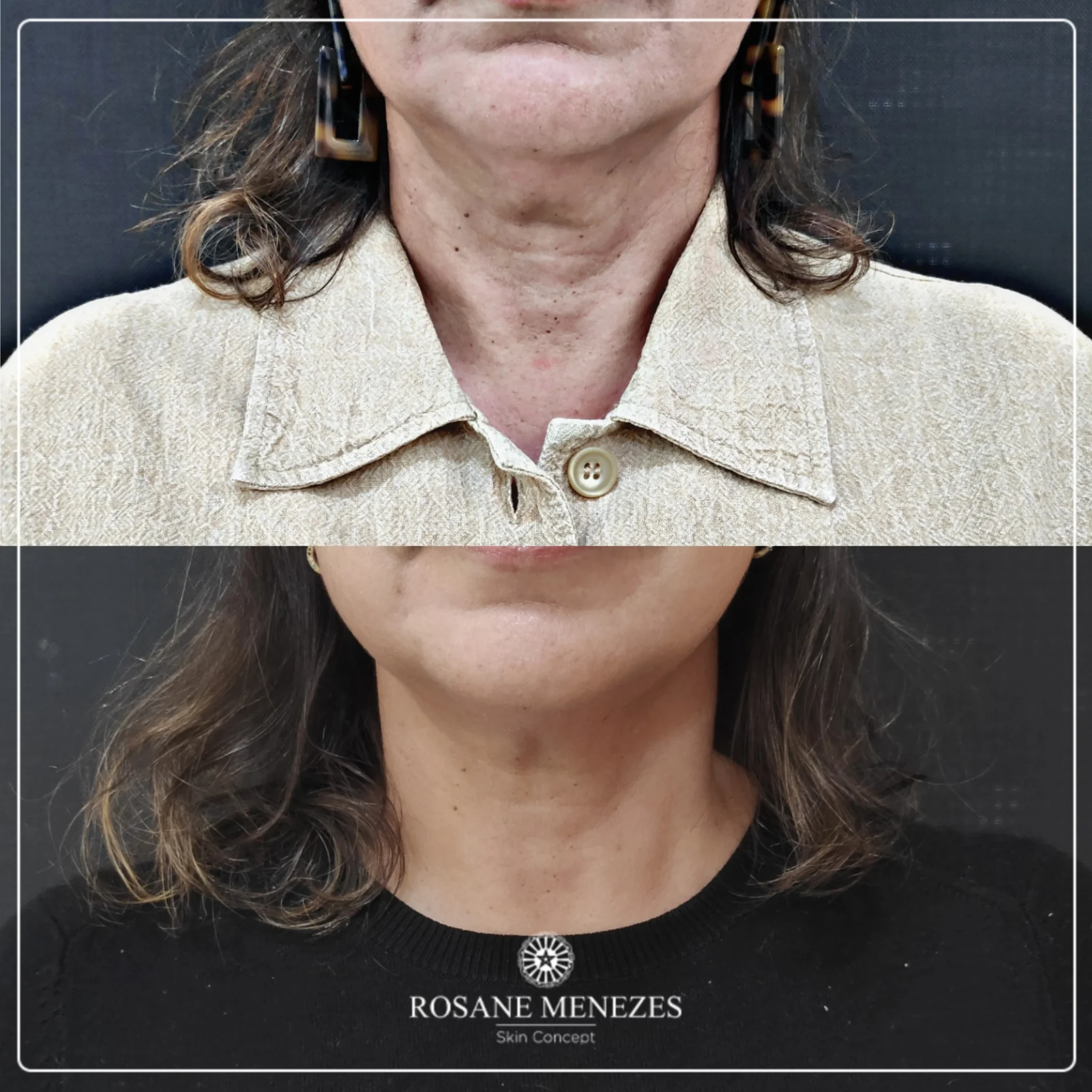 Tratamentos faciais 10-02 (1)